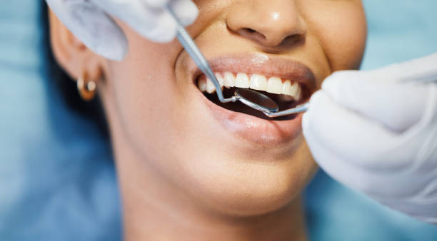 Best Emergency Root Canal Treatment in Whitinsville, MA